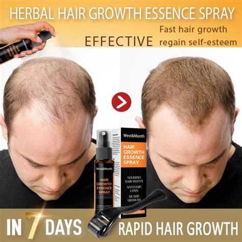 hairtech hair grower|HairTech Hair Grower The Holy Grail for Regaining Your